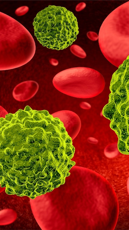 18.dez.2015 - Células cancerígenas se espalham e crescem no corpo - iStock