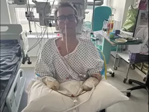 Mãos e pés azuis: político britânico tem amputação quádrupla após sepse