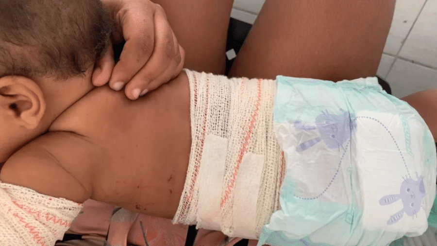 Bebê foi atingida por rojão arremessado por cliente de bar no interior de Goiás - Polícia Civil/Divulgação