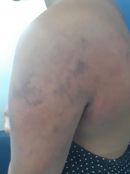 Mulher disse à polícia ter sido agredida por 6 horas pelo marido em Nova Iguaçu (RJ) - Divulgação/Polícia Civil