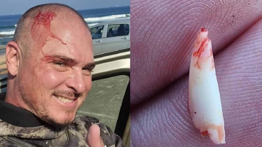 Pescador na África do Sul mostra dente de tubarão - Reprodução/Facebook