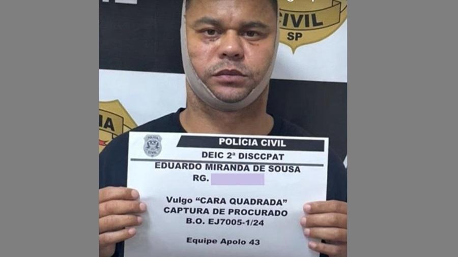 Homem conhecido como 'Cara Quadrada' foi preso após cirurgia plástica em SP