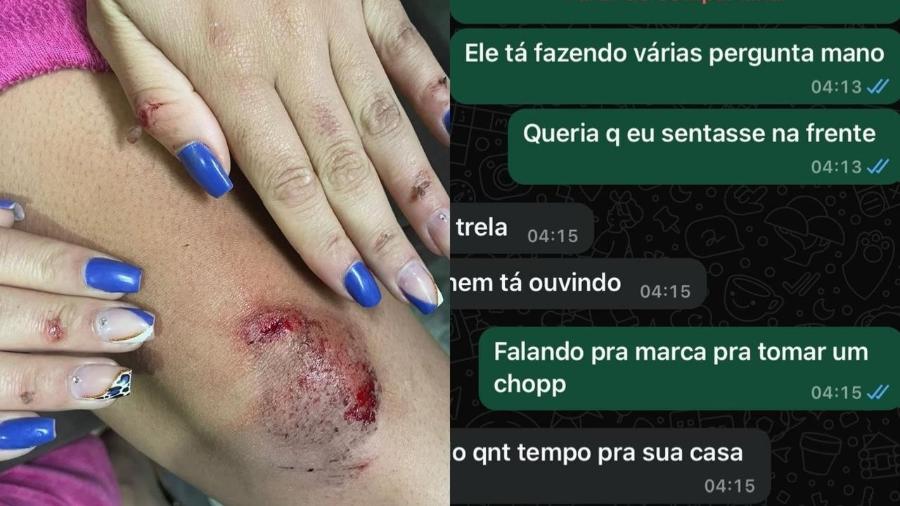 Vítima de importunação sexual publicou fotos de hematomas após de pular do carro  - Reprodução de redes sociais