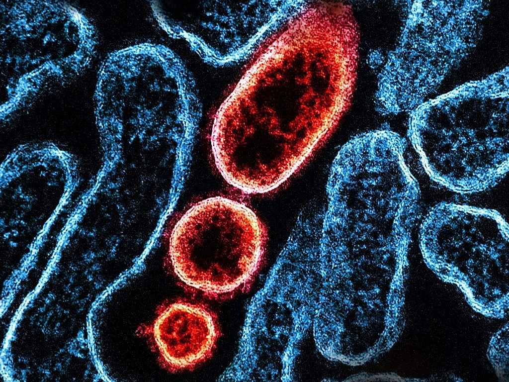 Alerta Máximo! Novo Vírus Nipah Ameaça com Taxa de Mortalidade Assustadora: 75%?