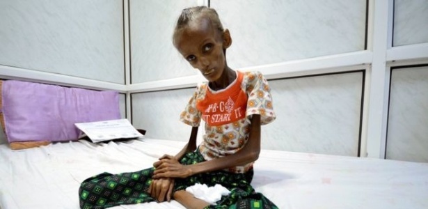 Saida começou a sofrer de desnutrição há cinco anos, segundo a família, mas sua situação se agravou com a guerra civil no país - Reuters