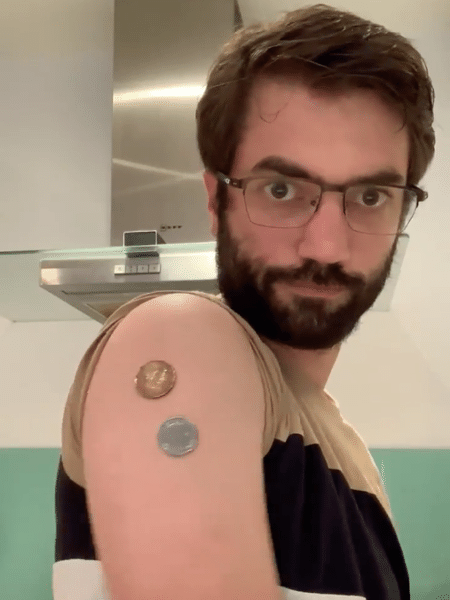 Em vídeo postado no Twitter, o médico Ricardo Parolin mostra que para grudar itens no braço só é necessário um pouco de umidade - Reprodução/Twitter/@parolin_ricardo