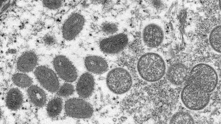 O monkeypox visto em microscópio eletrônico - CDC/REUTERS