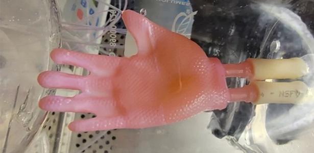 Cientistas criam pele no formato de mão com impressora 3D: 'Como uma luva' - VivaBem