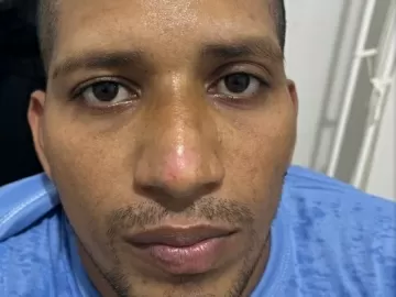 Laudo e fotos apontam que fugitivo de Mossoró tinha lesões após prisão 