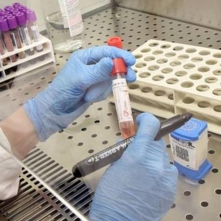 Ministério da Saúde informa apenas o número de testes distribuídos aos estados - EPA