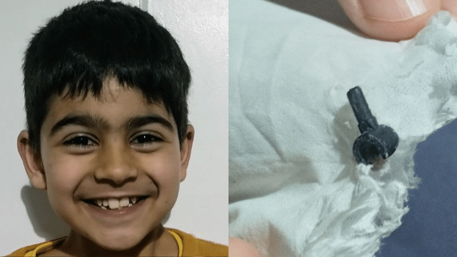 O garoto Sameer Anwar, que achou uma pequena peça de Lego dentro do nariz. Ele mesmo havia colocado a peça no nariz há cerca de dois anos - Arquivo pessoal/Mudassir Anwar