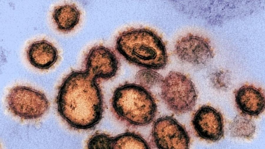 No último sábado, o Reino Unido anunciou a descoberta de uma nova variante do coronavírus mais infecciosa e "fora de controle", segundo o ministro da Saúde britânico Matt Hancock - EPA via BBC