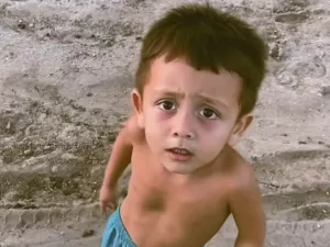 'Que foi, mulher?': menino famoso por vídeo faz cirurgia após vaquinha