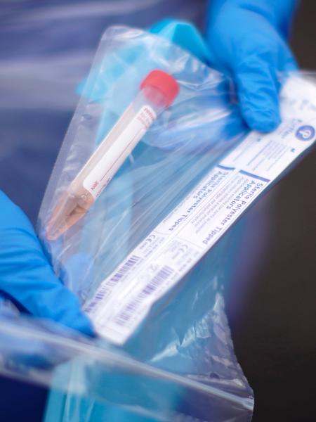 Testes para a doença covid-19, causada pelo novo coronavírus - Christopher Furlong/Getty Images