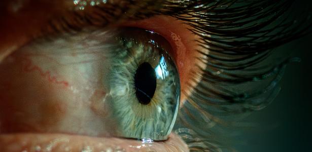 'Venda do olho' já foi proibida em outros países; saiba onde e por quê