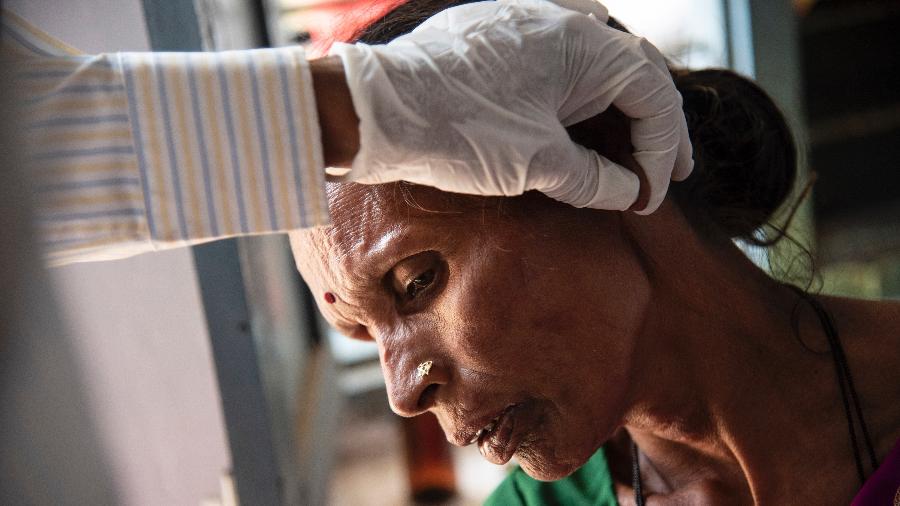 Mulher com hanseníase é tratada em clínica em Mahabubnagar, na Índia - Saumya Khandelwal/The New York Times