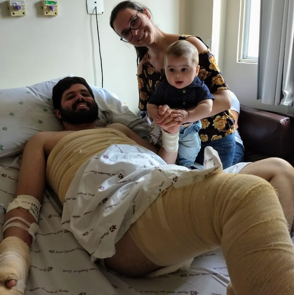 Achavam que eu havia morrido: ele levou choque de 13 mil volts