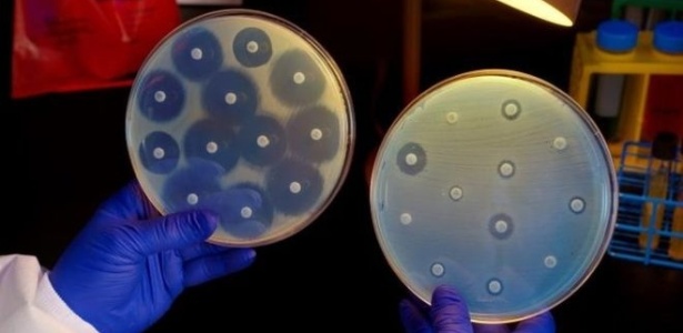 Brasil tem alguns dos maiores índices de resistência em determinadas bactérias, segundo especialista - CDC