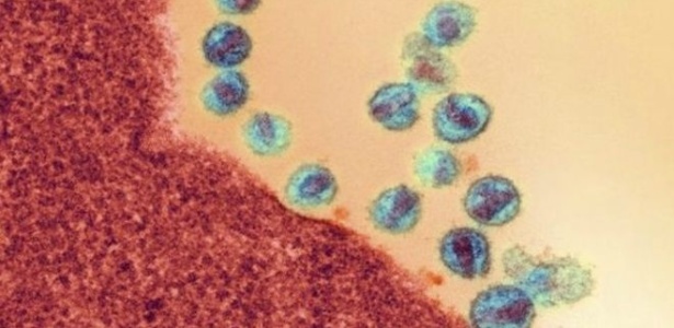 Tratamento com antirretrovirais não consegue atingir HIV "oculto"  - BBC