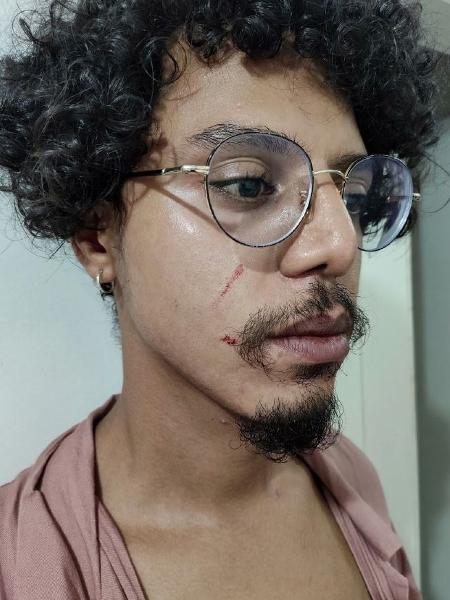 Renan da Silva Rodrigues acusou um segurança de agredi-lo em um supermercado de Florianópolis - Arquivo pessoal