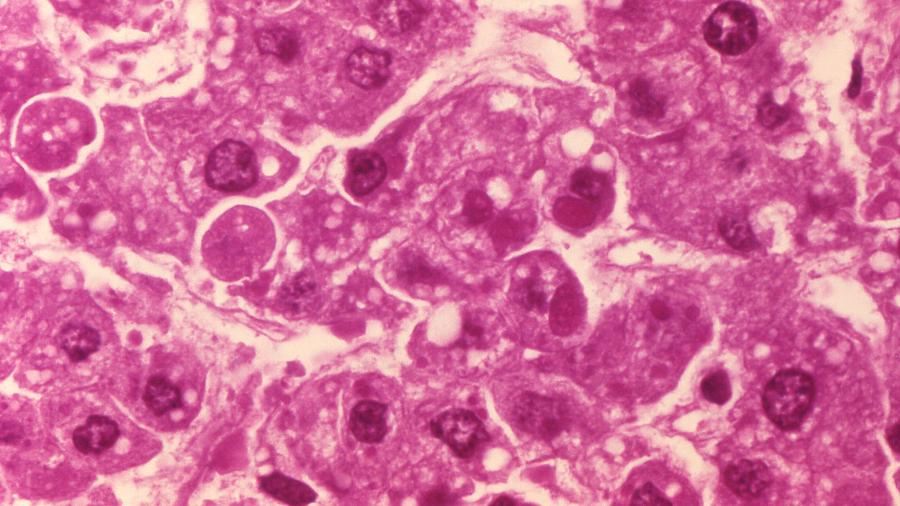 Microscópico mostra infecção por ebola - Smith Collection/Gado/Getty Images