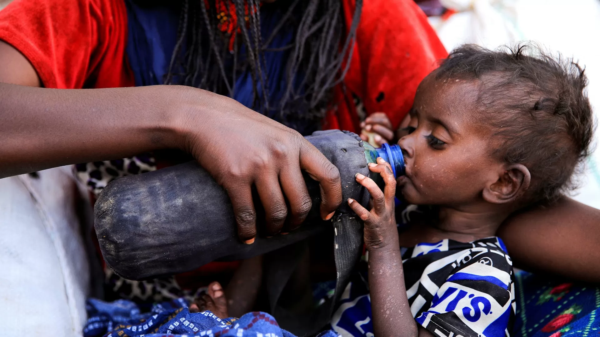 Uma criança gravemente desnutrida bebe diretamente na garrafa em um campo para deslocados de guerra
