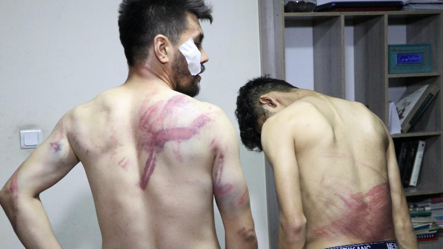 08.set.21 - Jornalistas mostram seus ferimentos após serem espancados pelo Talibã em Cabul, Afeganistão - ETILAATROZ/ETILAATROZ via REUTERS