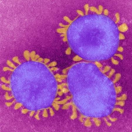 Imagem meramente ilustrativa - Centro Europeu de Controle de Doenças informou que 26 países relataram a presença em seus cidadãos da variante britânica do coronavírus - BSIP