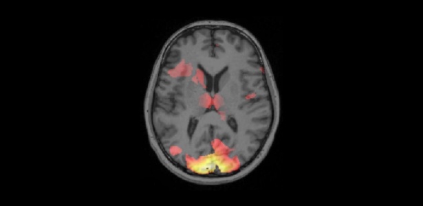 Varredura da atividade cerebral mostrando padrões de atividade relacionados à memória do medo - Ai Koizumi