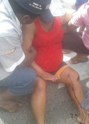 Lindinalva Pereira de Lima Filha foi atingida por um tiro na perna esquerda - MST/Divulgação
