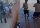 Mulher é mordida por tubarão em praia no Recife; ataque é o 2º em dois dias