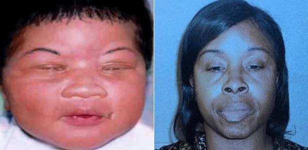 Kamiyah Mobley quando bebê e a mulher presa por seu sequestro, Gloria Williams - Polícia de Jacksonville