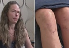 Mulher denuncia médico após cirurgia feita no joelho errado no PR - Reprodução: RPCTV