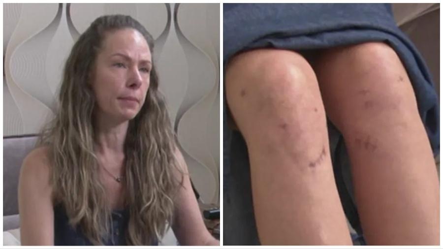 Bianca Petermann Stoeckl disse que foi operada do joelho errado em Foz do Iguaçu (PR)