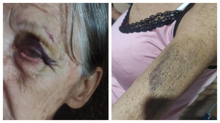 Laura Rosa de Jesus foi agredida por agentes da PCGO, segundo a defesa