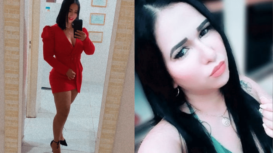 Joana Darque, 30, sofre com sequelas de infecção após cirurgia plástica malsucedida  - Reprodução/Facebook