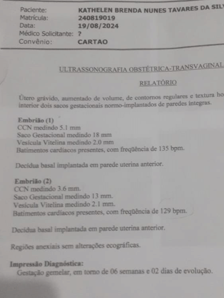 Ultrassom feito em clínica particular identificou gestação de gêmeos Ultrassom feito em clínica particular identificou gestação de gêmeos