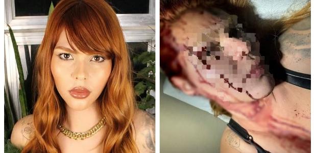 Modelo trans é espancada por seis vizinhos em SP: 'Foram para me matar'