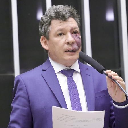  O deputado federal Reginaldo Lopes (PT-MG) propõe apensar PECs de redução da jornada de trabalho