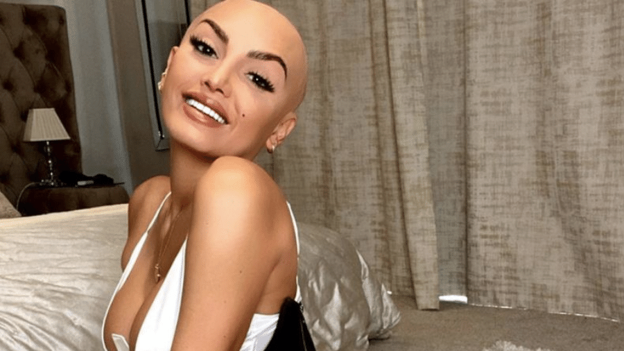 A influencer Zaralena Jackson, que tem alopecia - ZARALENA JACKSON