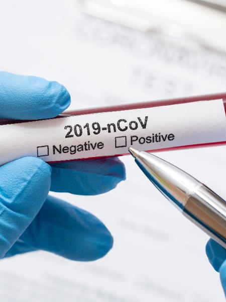Teste para deterctar o novo coronavirus - Freepik