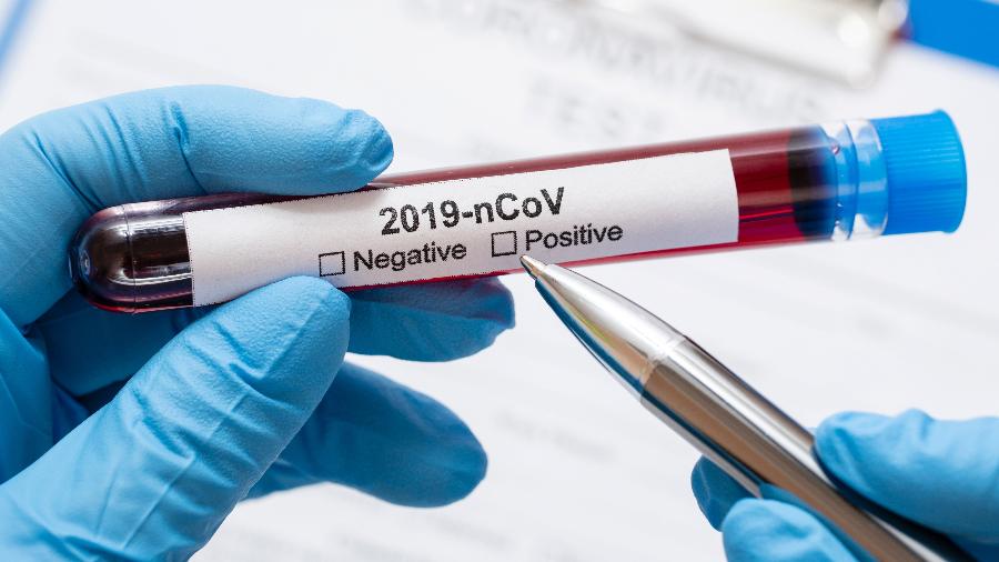 Os testes mais comuns do novo coronavírus envolvem exames feitos a partir de amostras de sangue - Freepik