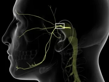 'Pior dor do mundo': neuralgia do trigêmeo dá sensação de pontada e choque