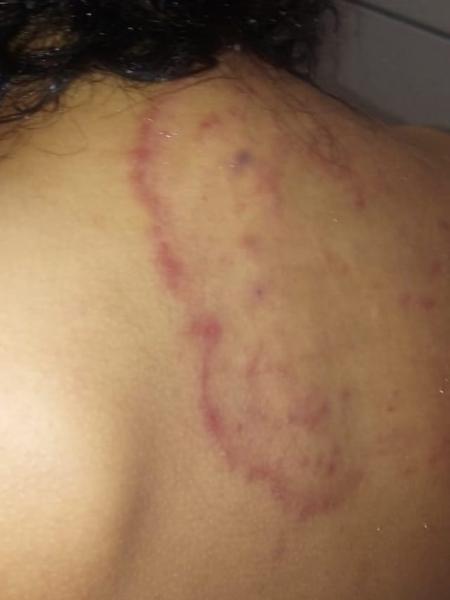 Imagem mostra machucados supostamente causados em asilo de MG - Divulgação/Polícia Civil MG