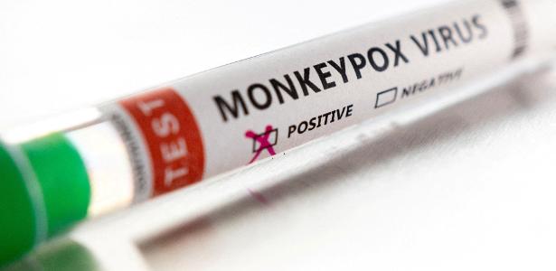 US begins clinical trials of monkeypox vaccine US begins clinical trials of monkeypox vaccine