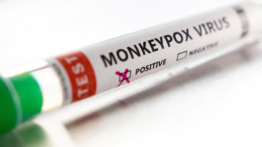 Tubo de ensaio com etiqueta que indica teste positivo para a varíola do macaco - REUTERS/Dado Ruvic/Illustration