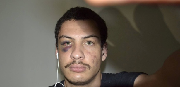 Lucas Acacio de Souza, 23, postou nas redes sociais que foi agredido na orla de Santos (SP) por seis homens por ser gay - Reprodução/Facebook