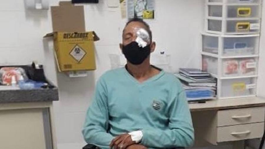 Daniel Campelo ficou cego após ser atingido em protesto no Recife  - Arquivo pessoal