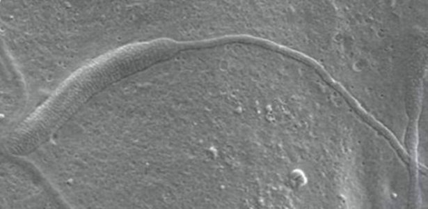 Acredita-se que espermatozóide seja o mais antigo já encontrado - Biology Letters/BBC