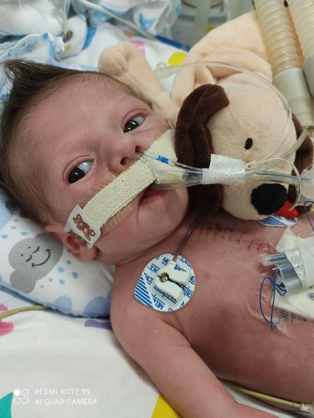 O bebê Luiz tem uma cicatriz que lhe corta o peito: ele passou por uma cirugia aos 4 dias de vida  - Arquivo Pessoal